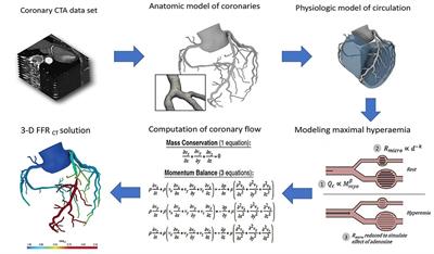 An Introductory Overview of Image-Based Computational Modeling in Personalized Cardiovascular Medicine